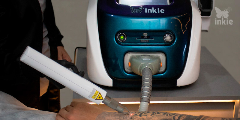 Aplicadora fazendo sessão no braço do cliente para despigmentar tatuagem a laser com o Inkie Laser