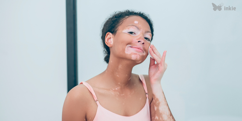 Mulher com vitiligo fazendo limpeza da pele