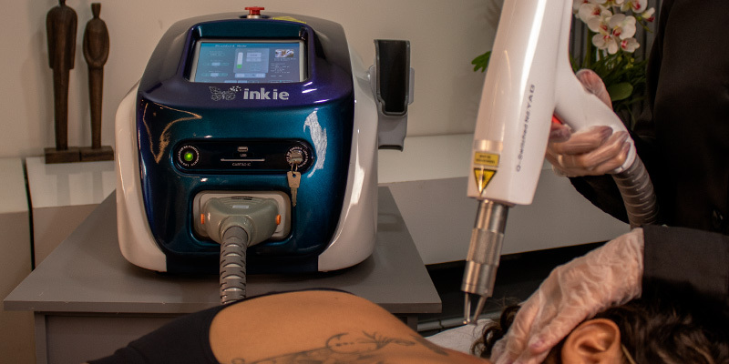 Pessoa deitada se submetendo ao processo de remoção de tatuagem com o Inkie Laser