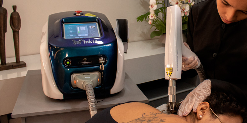 Tudo que você precisa saber antes de um tratamento a laser para tirar tatuagem